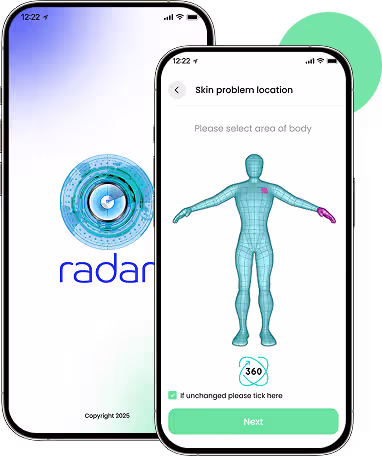 Bantham RADAR mobile app screens for remote dermatology triage
