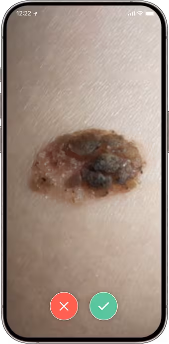 Dermatology image review screen before patient submission