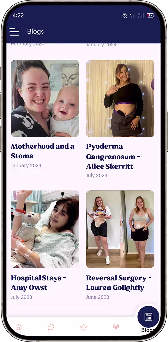 Educational blogs and podcasts for the ostomy community