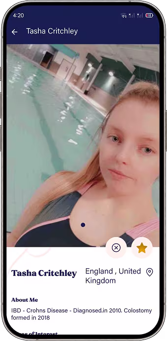 Peer matching screen for discovering relevant ostomy community members